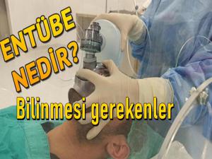 Entübe nedir? Entübe hakkında neler biliyoruz?